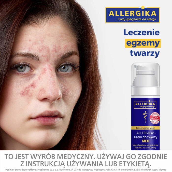 allergika_krem_do_twarzy_leczenie_egzema_twarzy_azs