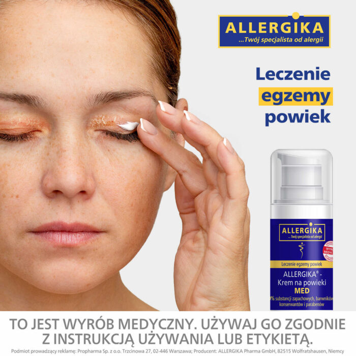 allergika_krem_na_powieki_leczenie_egzemy_powiek