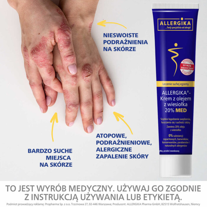 krem-z-olejem-z-wiesiolka-na-sucha-egzeme-azs