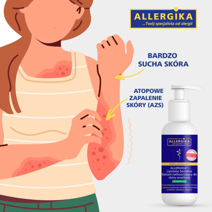 allergika_lipolotio_sensitive_balsam_sucha_skora